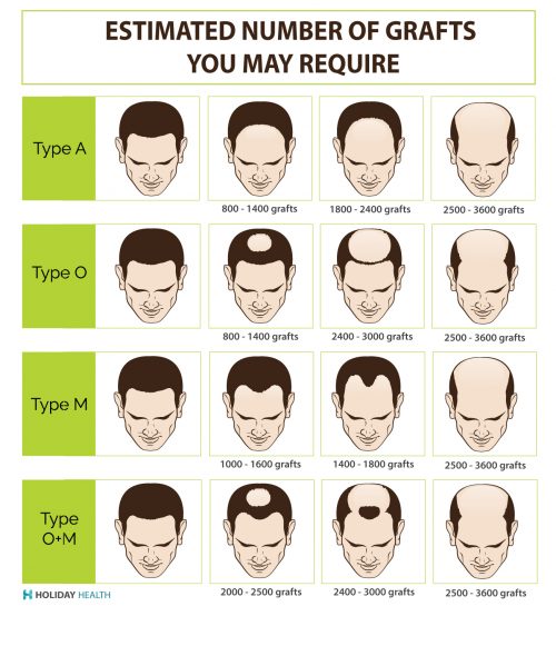 Hair transplant cost International price comparison guide for hair